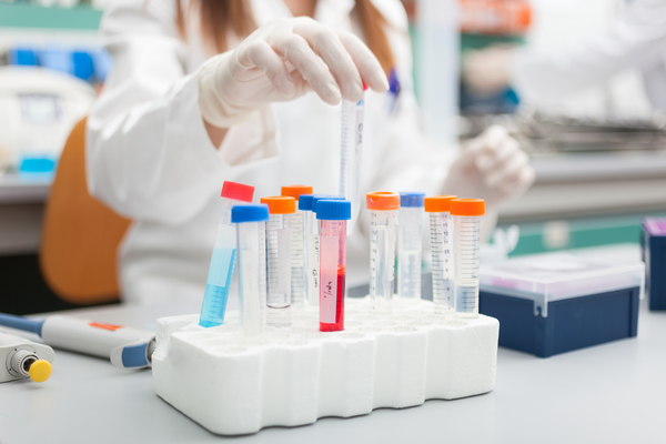 PEGylated Liposomes in Drug Delivery: Formulation and Design Considerations