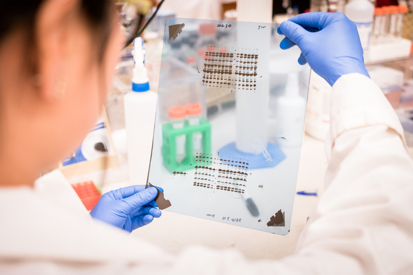 PEG Lipids in Drug Delivery: Structure, Function, and Selection Guide