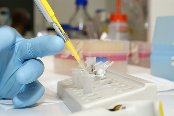 PEG Linkers for Drug Delivery: Spacer Design and Functional Group Selection