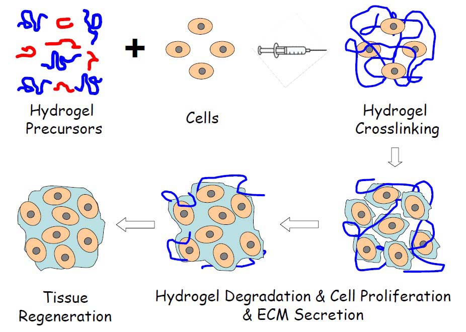 Schematic illustration of injectable hydrogel for tissue regeneration approaches